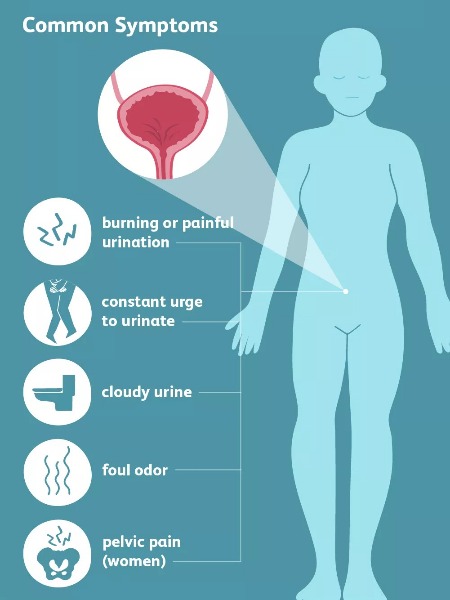 UTI (URINARY TRACT INFECTION)